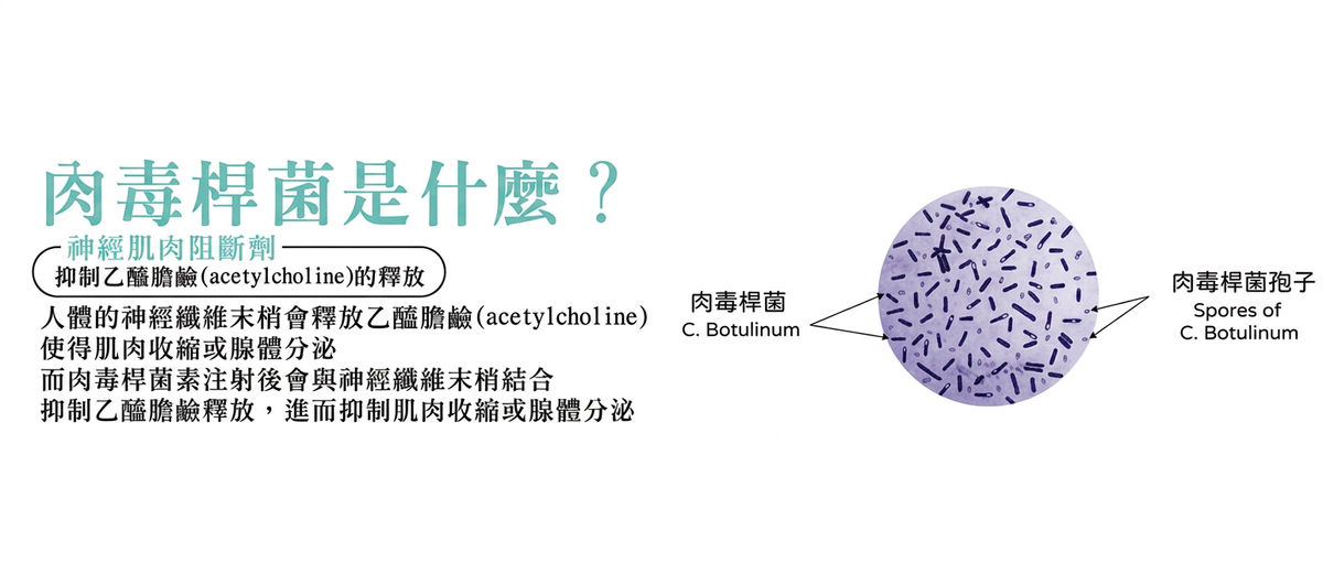 肉毒桿菌是什麼:神經肌肉阻斷劑,抑制乙醯膽鹼釋放