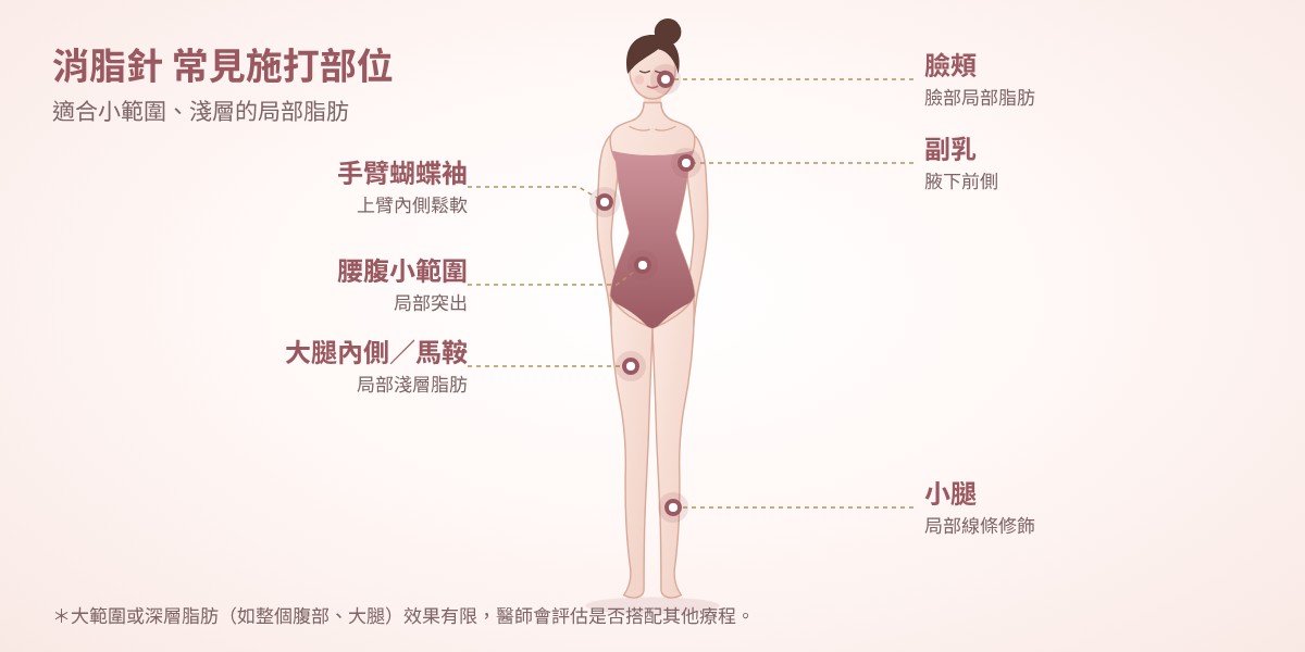 消脂針常見施打部位:臉頰、手臂蝴蝶袖、副乳、腰腹小範圍、大腿內側與馬鞍、小腿