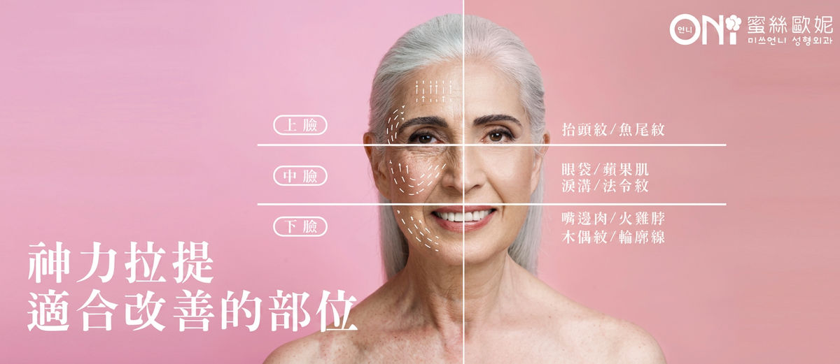 神力拉提適合改善的部位:上臉、中臉、下臉
