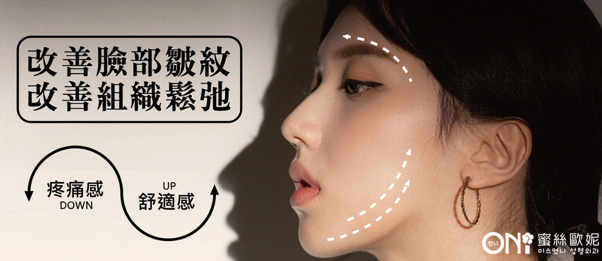 神力拉提 MINT LIFT:改善臉部皺紋、改善組織鬆弛