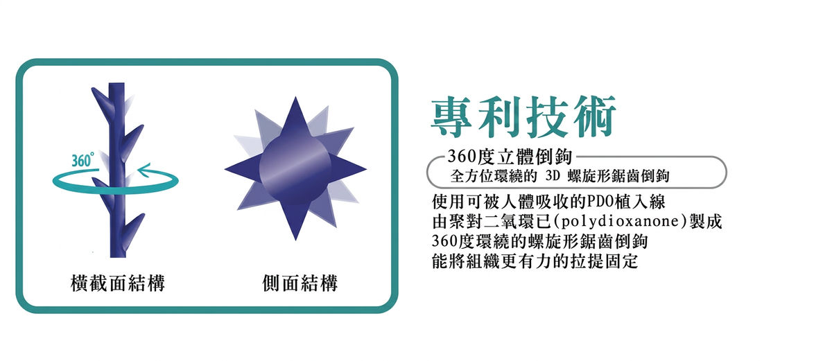 MINT LIFT 專利技術:360 度立體倒鉤,3D 螺旋形鋸齒倒鉤