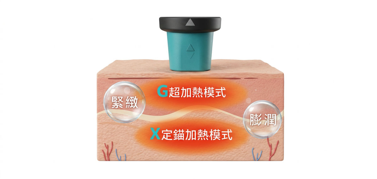 超玩美X電波療程說明圖 2