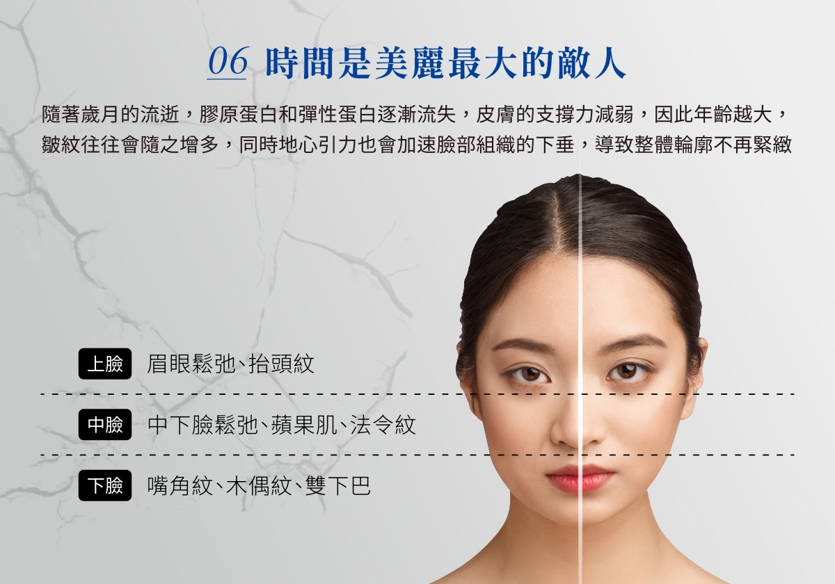 埋線拉提適合部位:上臉眉眼鬆弛、中臉蘋果肌與法令紋、下臉嘴角紋與木偶紋