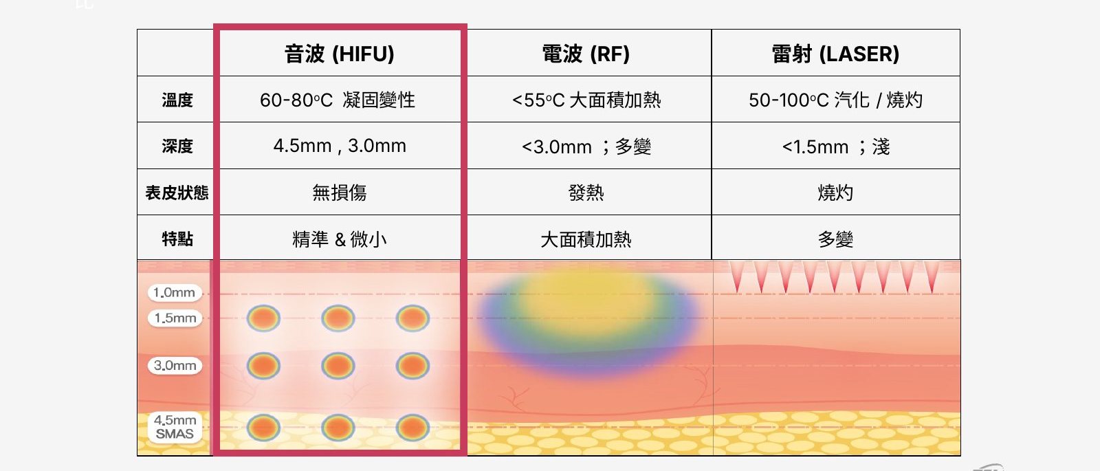 十倍雙線音波療程說明圖 3