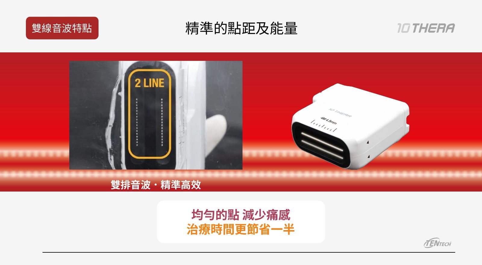 十倍雙線音波療程說明圖 4