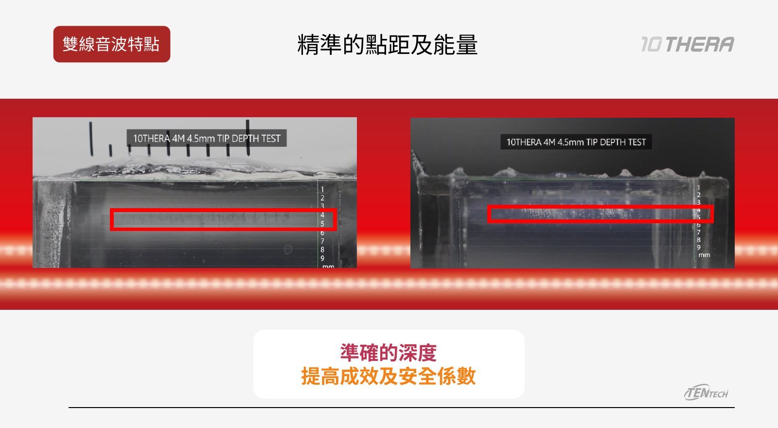 十倍雙線音波療程說明圖 5