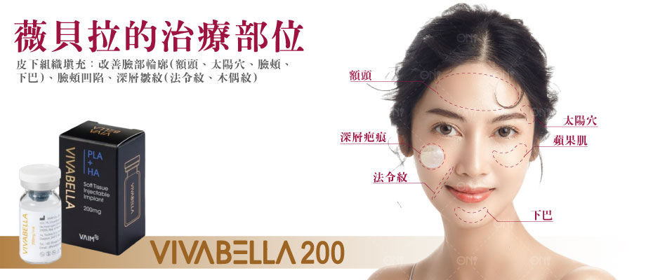 VIVABELLA 200 治療部位:額頭、太陽穴、蘋果肌、深層凹陷、法令紋、下巴