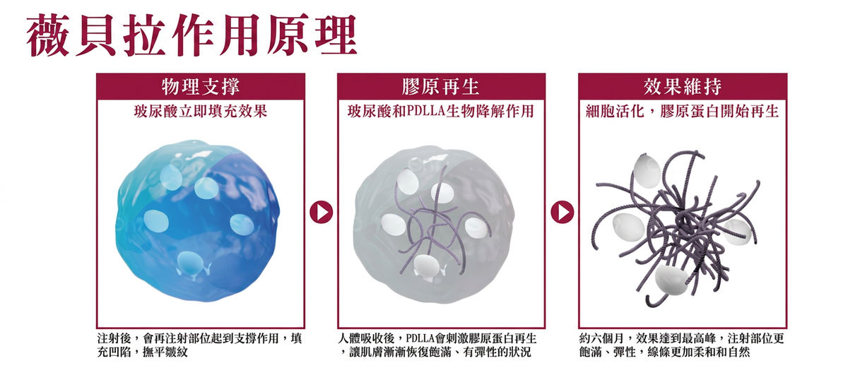 薇貝拉作用原理:物理支撐、膠原再生、效果維持