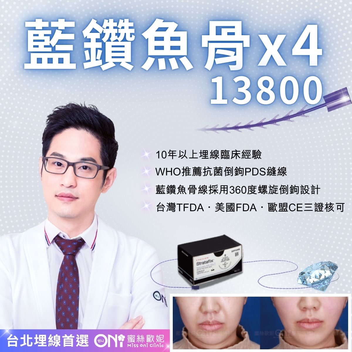藍鑽魚骨-13800